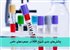 چالش‌های جدی شیوع HIV در جمعیت‌های خاص