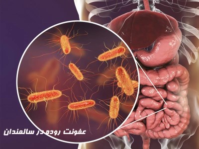 علت عفونت روده در سالمندان