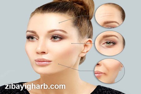 هزینه تزریق ژل و بوتاکس در صادقیه