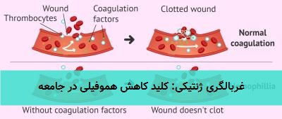 غربالگری ژنتیکی: کلید کاهش هموفیلی در جامعه