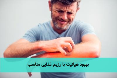 بهبود هپاتیت با رژیم غذایی مناسب