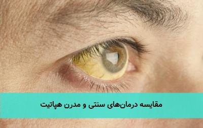  مقایسه درمان‌های سنتی و مدرن هپاتیت 