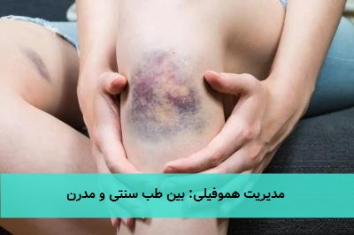  مدیریت هموفیلی: بین طب سنتی و مدرن 