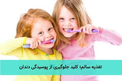  تغذیه سالم؛ کلید جلوگیری از پوسیدگی دندان 