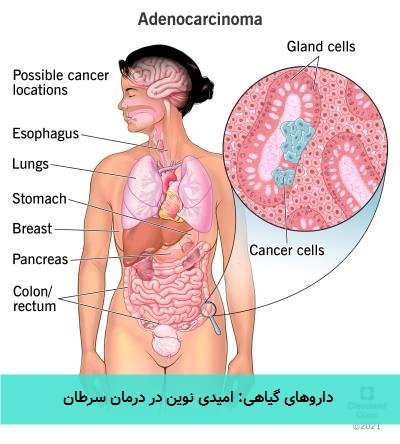  داروهای گیاهی: امیدی نوین در درمان سرطان 