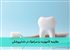 مقایسه کامپوزیت و سرامیک در دندانپزشکی