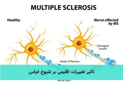 تأثیر تغییرات اقلیمی بر شیوع ام‌اس
