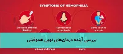 بررسی آینده درمانهای نوین هموفیلی