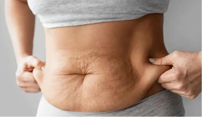 از بین بردن چروک شکم بعد از لاغری: راهنمای کامل سفت کردن پوست