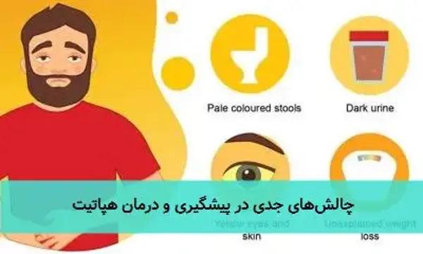 چالش‌های جدی در پیشگیری و درمان هپاتیت