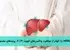 # موانع توسعه واکسن هپاتیت C و پیامدهای جهانی آن: تحلیلی جامع ## خلاصهای از چالشهای اصلی ### موانع علمی: - تنوع ژنتیکی فوقالعاده ویروس: HCV دارای ۷ ژنوتیپ اصلی و بیش از ۶۰ زیرنوع با توزیع جغرافیایی متنوع - نرخ جهش بالا: ناشی از عملکرد آنزیم RNA پلیمراز بدون قابلیت تصحیح خطا - چالش در شناسایی اپیتوپهای محافظتی: مناطق کلیدی پروتئینهای ویروسی به شدت متغیر و پنهان - مکانیسمهای فرار ایمنی: گلایکوزیلاسیون و تغییرات آنتیژنی سریع - مدلهای حیوانی محدود: عدم وجود مدل ایدهآل که دقیقاً بیماری انسان را تقلید کند ### موانع اقتصادی و ساختاری: - کاهش جذابیت بازار: با وجود درمانهای ضدویروسی مؤثر (DAAs) با موفقیت ۹۵٪+ - هزینه بالای تحقیق و توسعه در مقابل بازگشت سرمایه نامطمئن - اولویتبندی نابرابر بیماریها در تأمین مالی جهانی سلامت - جمعیتهای پرخطر به حاشیه رانده شده: مصرفکنندگان تزریقی مواد، زندانیان ### پیامدهای بهداشت عمومی: - تداوم انتقال ویروس: با وجود درمانهای موجود - بار اقتصادی سنگین: هزینههای مستقیم درمان و عوارض، کاهش بهرهوری - تشدید نابرابریهای بهداشتی: شکاف درمانی بین کشورهای ثروتمند و فقیر - مانع در راهبرد حذف جهانی تا ۲۰۳۰: تعیین شده توسط سازمان جهانی بهداشت ## راهکارهای پیشرو و چشمانداز آینده ### پیشرفتهای پژوهشی امیدوارکننده: 1. واکسنهای بر پایه وکتور ویروسی (مانند ChAdOx1 HCV) 2. ایمونوژنهای نوترکیب مهندسیشده بر پایه پروتئین E2 3. فناوری mRNA (با الهام از موفقیت واکسنهای کووید-۱۹) 4. پپتیدهای مصنوعی برای القای پاسخ سلول T ### ضرورت همکاریهای بینالمللی: - افزایش سرمایهگذاری دولتی در تحقیق پایه - ایجاد کنسرسیومهای پژوهشی بینالمللی - مکانیسمهای تأمین مالی نوآورانه: مشارکت عمومی-خصوصی، پیشتعهدهای بازار - توسعه مدلهای مشابه صندوق جهانی مبارزه با ایدز، سل و مالاریا ### استراتژیهای ترکیبی تا دستیابی به واکسن: - گسترش دسترسی به آزمایشهای ارزان و سریع - کاهش قیمت درمانها از طریق تولید ژنریک - تقویت برنامههای کاهش آسیب - مبارزه با انگ اجتماعی مرتبط با بیماری - ظرفیتسازی در سیستمهای بهداشتی اولیه ## جمعبندی نهایی عدم دسترسی به واکسن هپاتیت C نمایانگر چالشی چندبعدی است که فراتر از موانع علمی صرف، مسائل اقتصادی، ساختاری و اخلاقی را دربرمیگیرد. در حالی که درمانهای موجود دستاورد بزرگی محسوب میشوند، آنها نمیتوانند جایگزین استراتژی پیشگیرانه مؤثری مانند واکسیناسیون شوند. تجربیات موفق در توسعه واکسن برای ویروسهای دیگر (مانند HPV و کووید-۱۹) نشان میدهد که با اراده سیاسی قوی، سرمایهگذاری پایدار و همکاری بینالمللی میتوان بر این چالشها غلبه کرد. دستیابی به واکسن هپاتیت C نه تنها یک پیشرفت علمی تاریخی خواهد بود، بلکه گامی اساسی به سوی عدالت در سلامت و حذف بیماریای است که به طور نامتناسبی جمعیتهای آسیبپذیر را تحت تأثیر قرار میدهد. جامعه جهانی باید این چالش را با همان فوریت و نوآوری که برای دیگر تهدیدات بهداشت جهانی به کار گرفته، مورد توجه قرار دهد.
