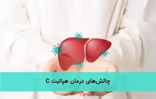 چالشهای درمان هپاتیت C چالشهای درمان هپاتیت C